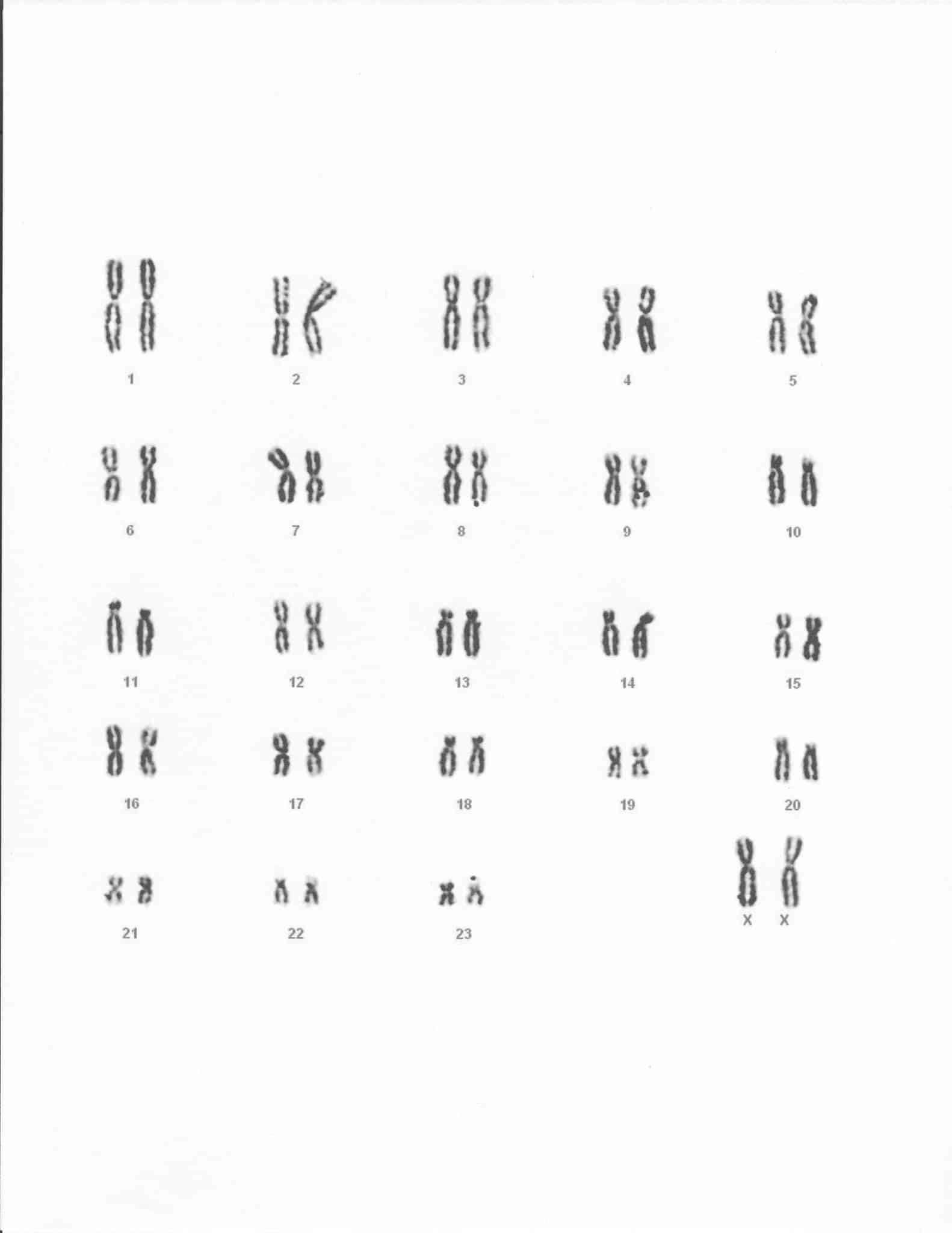 female-karyotype